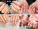 ビンナ(BINNA)の写真
