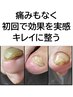 厚い変形爪ケア 靴の中で爪があたる 靴下が履きにくい 初回から効果を実感!