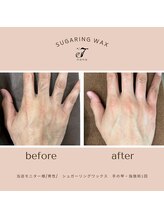 ナナ(nana)/◆before/after◆