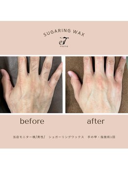 ナナ(nana)/◆before/after◆