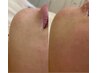 【フェイシャルWax】古い角質&産毛スッキリ！化粧ノリが悪い、お肌のざらつき