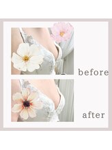 ビューティフィール アンド アリサナ(Beauty Feel&Arisana)/症例写真　バストケア