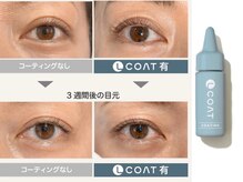 テンリリィ 光の森店(RiLy)/人気オプションLコート