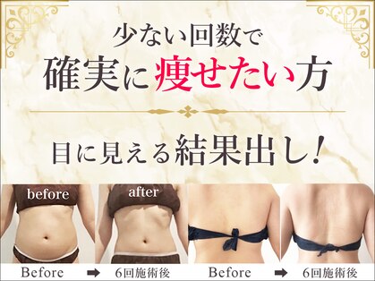 ミント(Mint)の写真