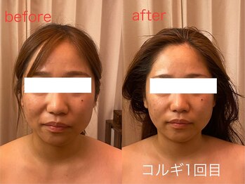 ビーキュート 神戸元町店(BE-CUTE)/コルギ1回目