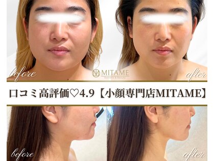 ミタメ 銀座店(MITAME)の写真