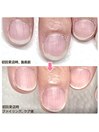 ビフォーアフター