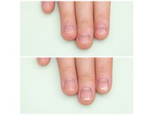 ティアラ(Tiara)の雰囲気（ひと月でこの育成♪指先に自信が無い方是非お試しくださいませ♪）