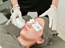 アズ(A's)/【脱毛】顔脱毛フェイシャル