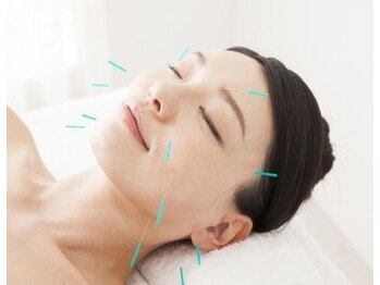 新越谷駅前鍼灸整骨院/美容鍼でくすまないお肌に♪