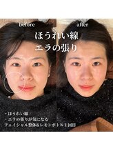 フェアリーフェイス 南森町店(Fairy Face)/南森町/小顔矯正&レモンボトル