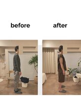 フィデル(fidele)/肩甲帯の機能回復、アプローチ例