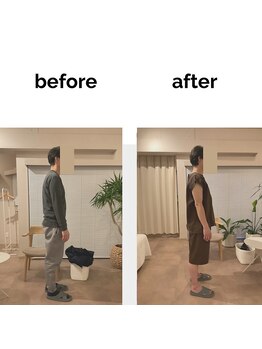 フィデル(fidele)/肩甲帯の機能回復、アプローチ例