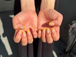 イエローフレンチ