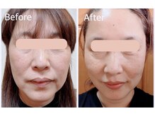 エステサロン ロータス(Lotus)の雰囲気（リフトアップで若見え。）