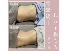 セル(cell)の雰囲気（腸もみ60分でこの変化！）