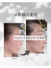 プレジール(Plaisir)/お手入れ1回