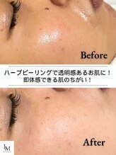 ベル 入間市(Belle)&nbsp;1回でお肌 白玉肌★