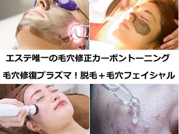 ナチュレアンドメディカ(Nature&Medica)の写真/エステでは難しい年齢,開き,凹凸,たるみ毛穴も徹底ケア!毛穴汚れ、皮脂も除去してキメ整う滑らか美肌に