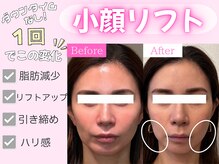 モテキ 表参道店(MoTeKi)