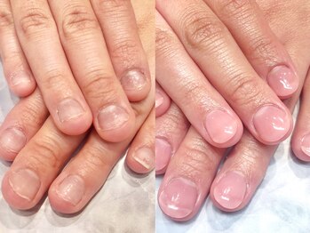 【スカルプ】自爪育成♪　春色