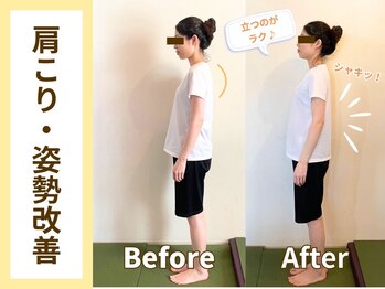 ゲンキ鍼灸整骨院 丸太町(Genki鍼灸整骨院)/猫背改善