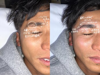 キャンバス 初台(CANVAS)/- Men's HBL - Before/After