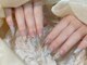 ドリーミーネイル 池袋(Dreamy Nail)の写真/お爪にコンプレックスがある方は当店にお任せ下さい！豊富なパーツと合わせて理想のデザインに仕上げます◎