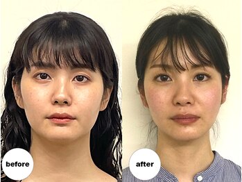 グランルーツ(GranRoots)