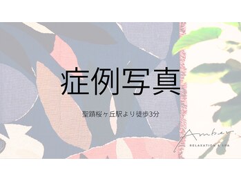 アンバー(Amber)/施術前・後のお身体の変化