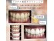 ホワイトニングプラス(Whitening+)の写真