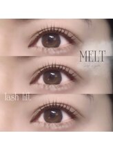 メルト(MELT)/小顔効果抜群☆立ち上げデザイン