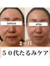【徹底小顔+プラズマリフトアップ】オールハンド小顔+プラズマシャワー90分