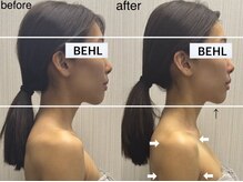 ベール(BEHL)/コルギのBefore After