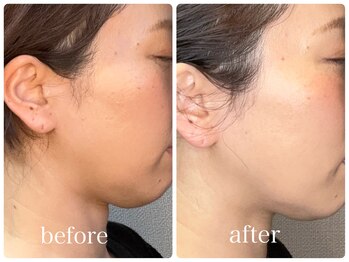 ピックアップ(pick-up)/パーソナルスパ後