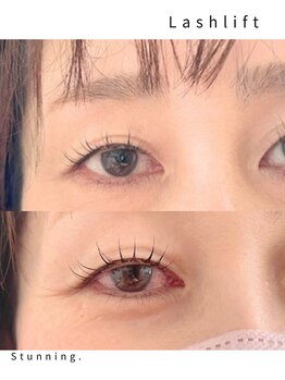 スタニング(Stunning.)/ラッシュリフト