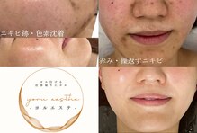 ヨルエステ(yoru aesthe)