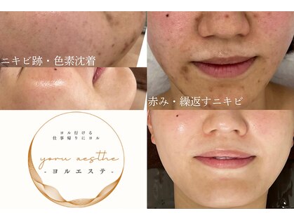 ヨルエステ(yoru aesthe)の写真