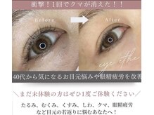 ラフィーユ 南風原店(Lafille)/アイパワーエステ