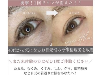 ラフィーユ 南風原店(Lafille)/アイパワーエステ