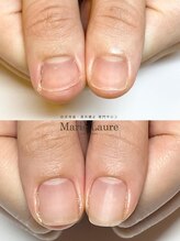 マリーロール 梅田店(Marie Laure)/自爪育成/深爪矯正/ネイルケア
