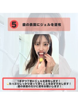 ホワイトニングショップ 福岡姪浜店/セルフホワイトニングのやり方