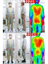 姫路なごみ整体院 なごみ鍼灸院/改善例：背中の痛み　猫背