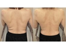 シュシュエステプリューム(Chou Chou Esthe PLUME)/