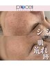 【プロセルセラピーズ肌質改善】真剣にお悩みの方はこちらを◎¥45,000