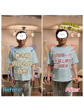 整体院ヒカリノキュウジツ さくら店/症例紹介★巻き肩改善