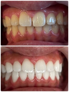 アンドホワイト 八日市店(&white)/メディカルホワイトニング