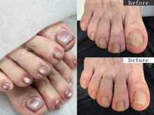 ベルル(Bellulu)の雰囲気（《足の爪・改善》お悩みの方、ぜひお気軽にご相談下さいね♪）