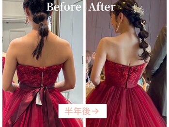 アティレ オオサカ(Attirer Osaka)/2023年秋冬婚