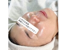 イリス(Iris)の雰囲気（高周波リフトでたるみケアと美肌を同時ケア！フェイスラインUP◎）